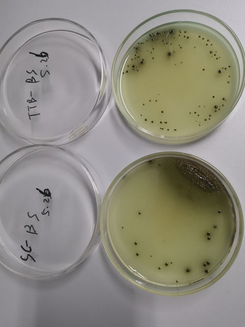 沙门氏菌生化鉴定操作要点解析与常见疑问解答